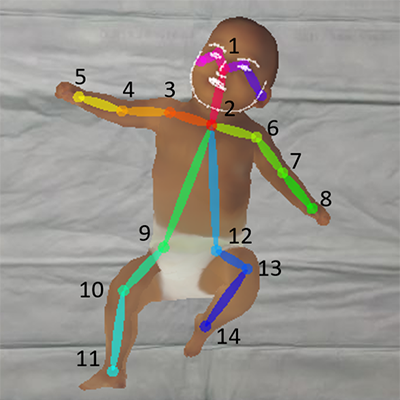 Abnormal Infant Movements Classification with Deep Learning on Pose-Based Features