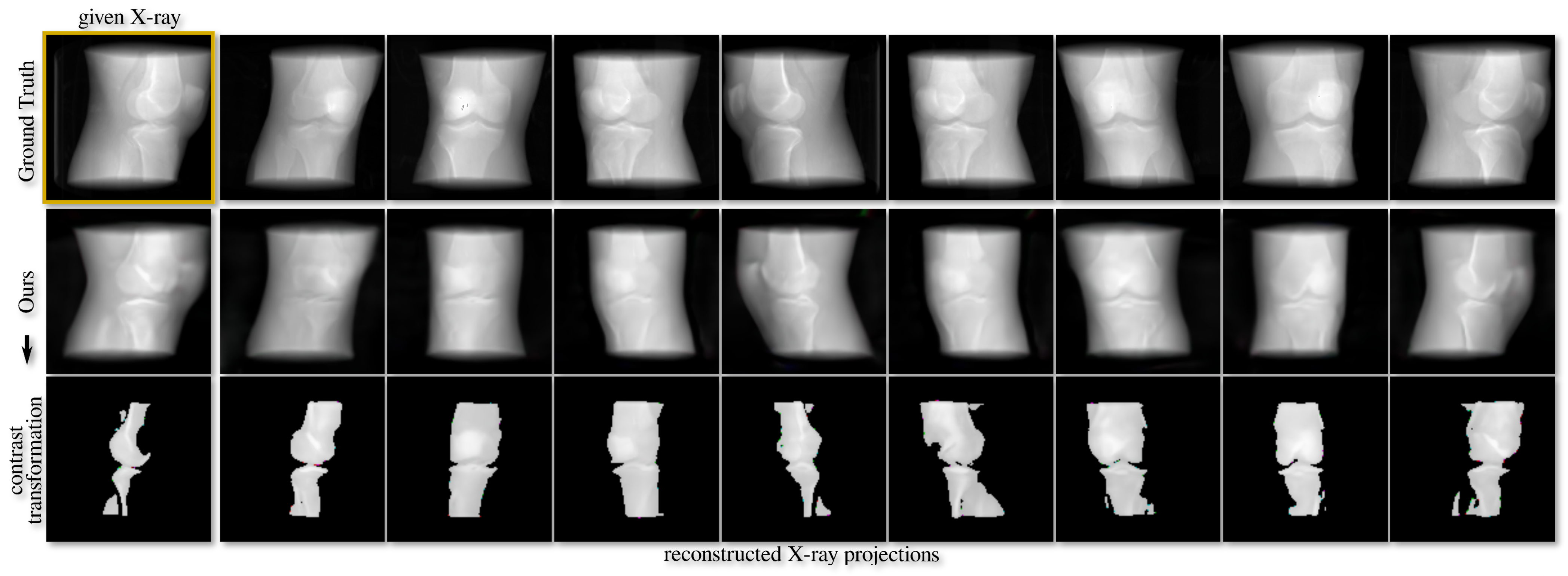 MedNeRF: Medical Neural Radiance Fields for Reconstructing 3D-aware CT-projections from a Single X-ray